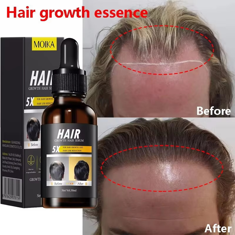 Hair Care Essential Oil Atomizing - Fast Hair Growth Serum Hair Regrowth