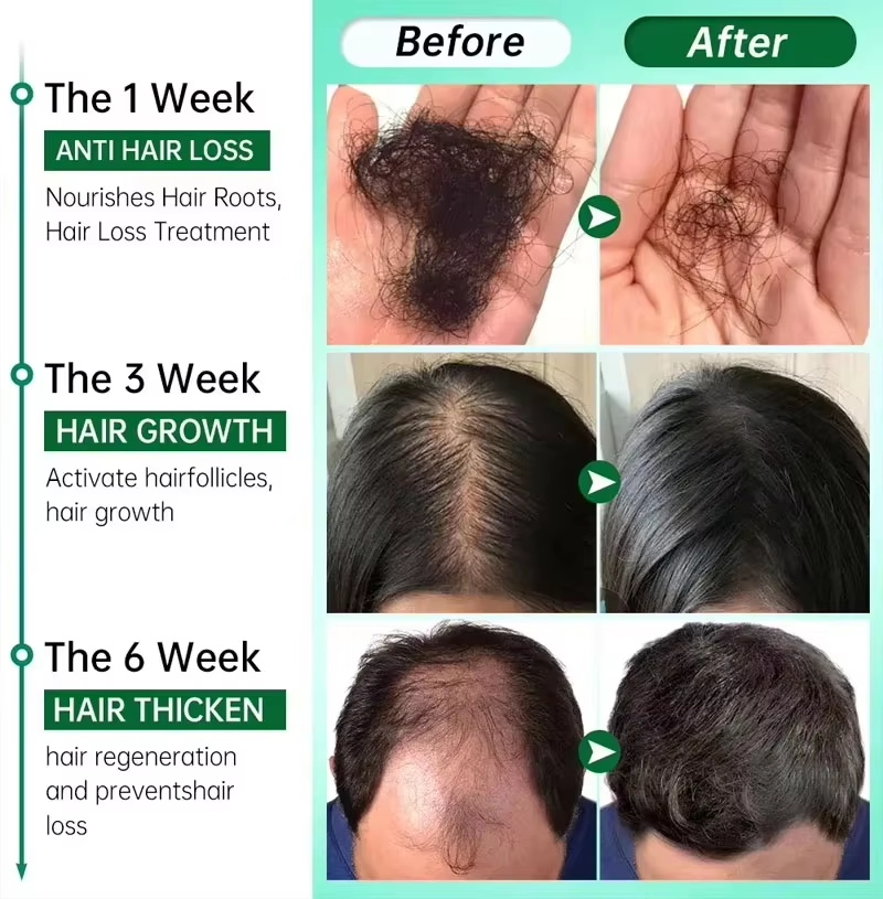 Hair Growth Serum 7 Days Fast  - Hair Care Capsule recension och pris