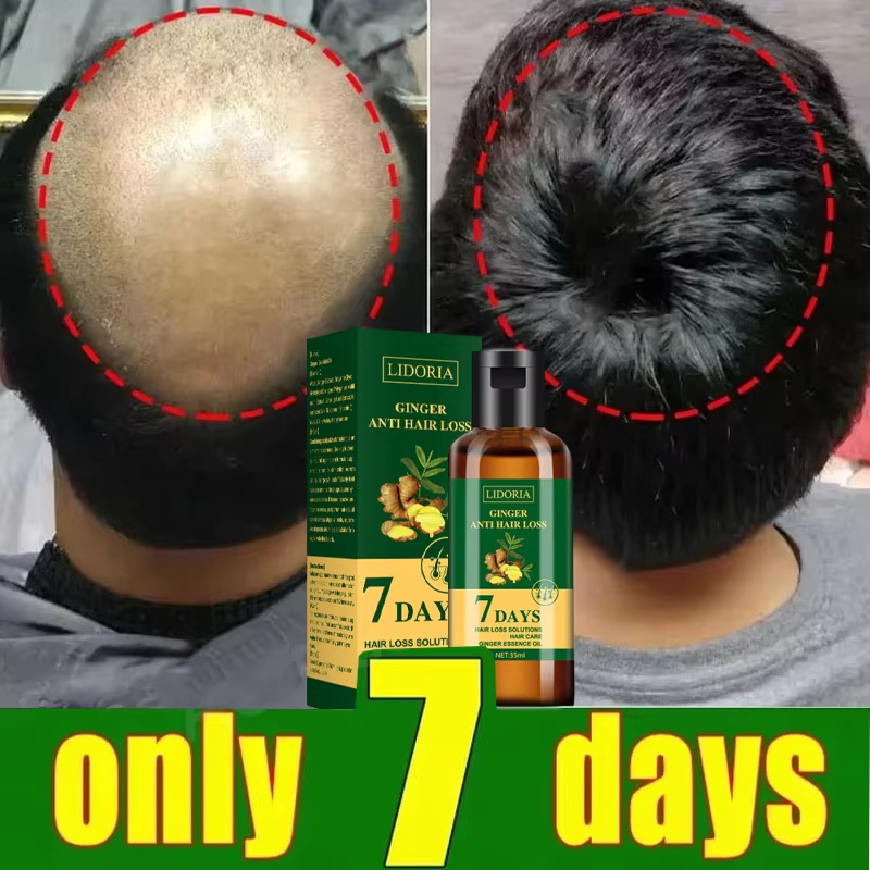 Hair Growth Serum 7 Days Fast  - Hair Care Capsule recension och pris