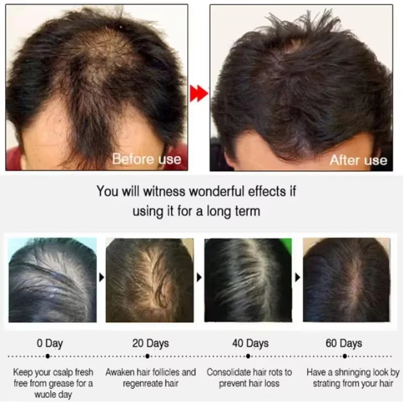Hair Growth Serum 7 Days Fast  - Hair Care Capsule recension och pris