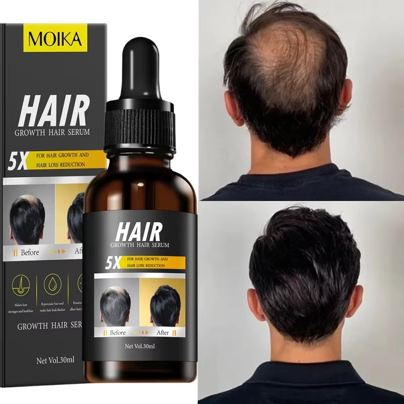 Fast Hair Growth Serum Hair Re - Hair Care Essential Oil Atomizing recension och pris