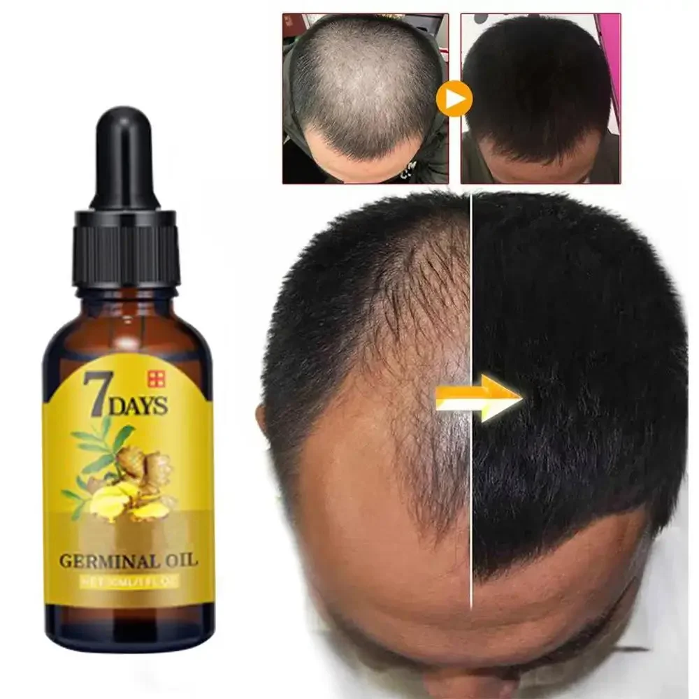 Hair Growth Ginger Fast Growin - Hair Care Essential Oil Atomizing recension och pris
